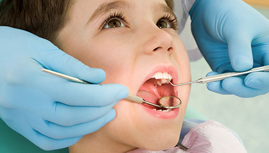 Image of a young patient with dental sealants